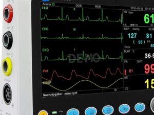 ECG Monitors
